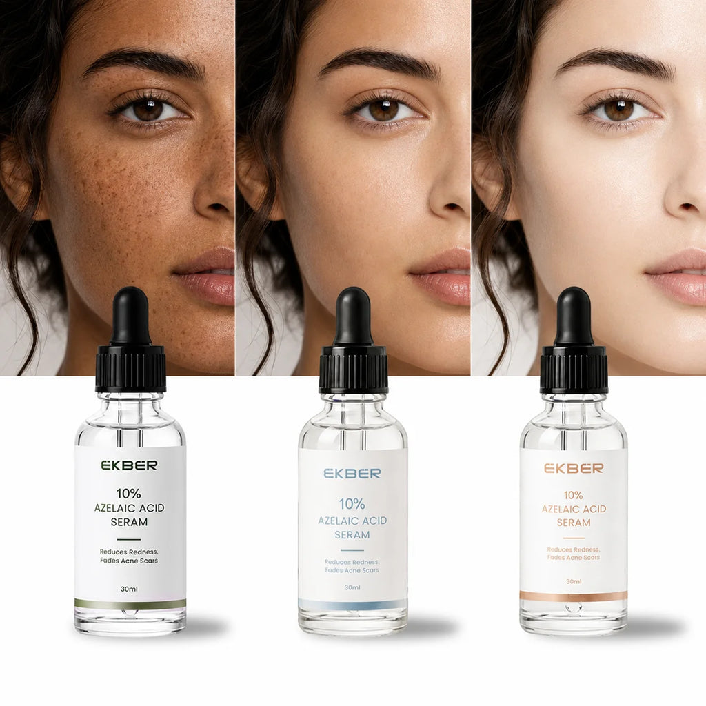 EKBER Medical Grade 10% Pure Azelaic Acid Serum Micronized Formula Non-Irritating Acne Pore Calming Serum Customizable