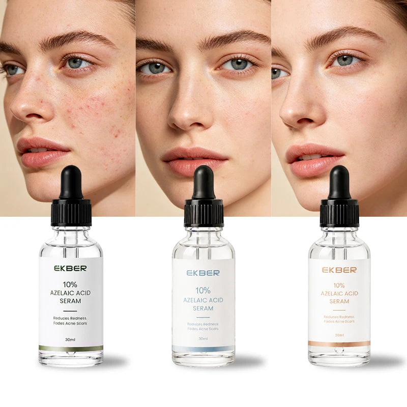 EKBER Medical Grade 10% Pure Azelaic Acid Serum Micronized Formula Non-Irritating Acne Pore Calming Serum Customizable