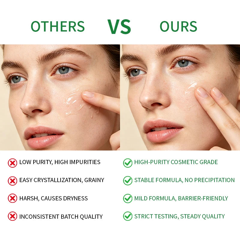 EKBER Medical Grade 10% Pure Azelaic Acid Serum Micronized Formula Non-Irritating Acne Pore Calming Serum Customizable