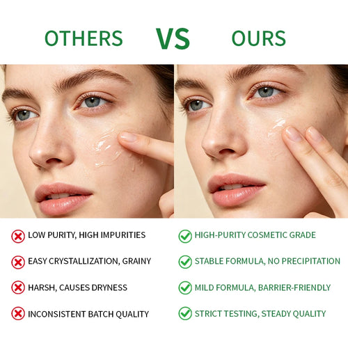 EKBER Medical Grade 10% Pure Azelaic Acid Serum Micronized Formula Non-Irritating Acne Pore Calming Serum Customizable